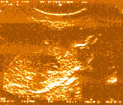 Scan image